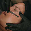 dermaplane facial