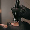 hydrofacial