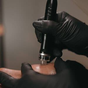 hydrofacial