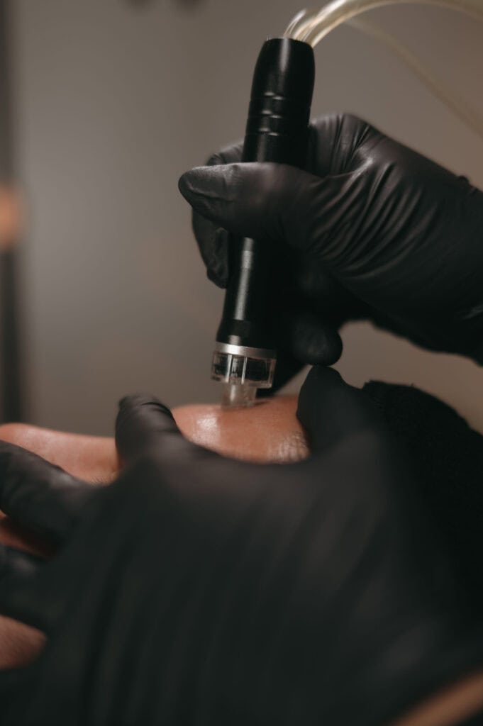 hydrofacial