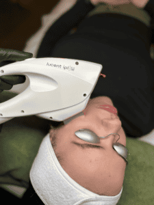 ipl facial 00