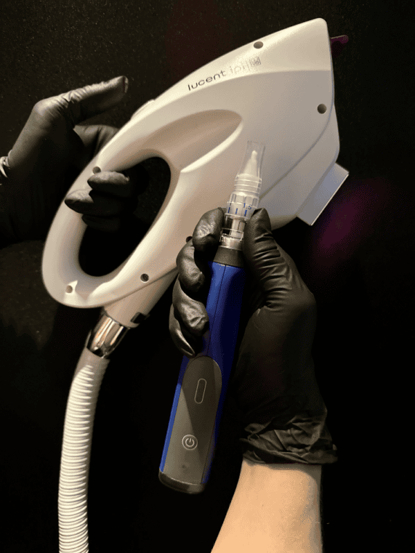 ipl facial 01