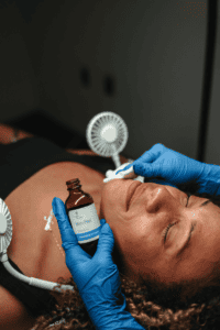 lindor health chemical peel