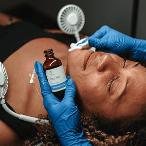 lindor health chemical peel
