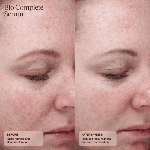 senté bio complete serum