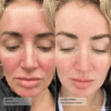 senté dermal repair cream