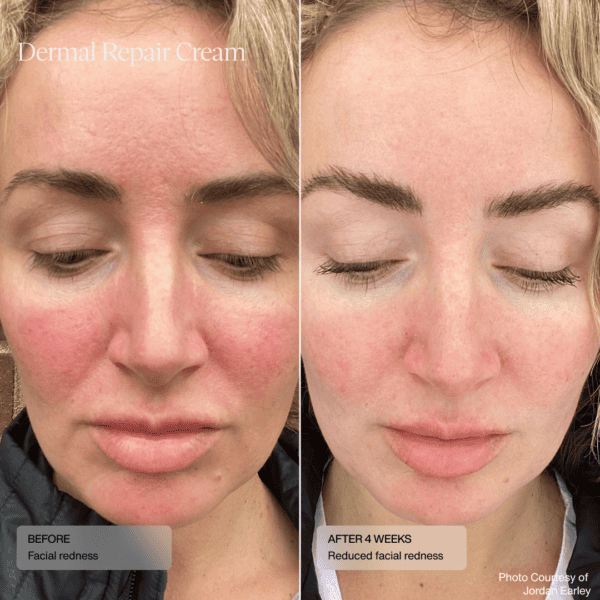 senté dermal repair cream
