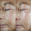 senté dermal repair cream ultra nourish