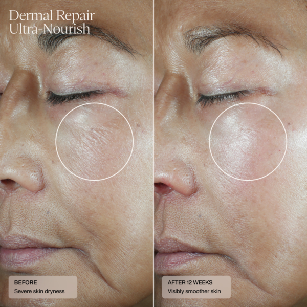 senté dermal repair cream ultra nourish