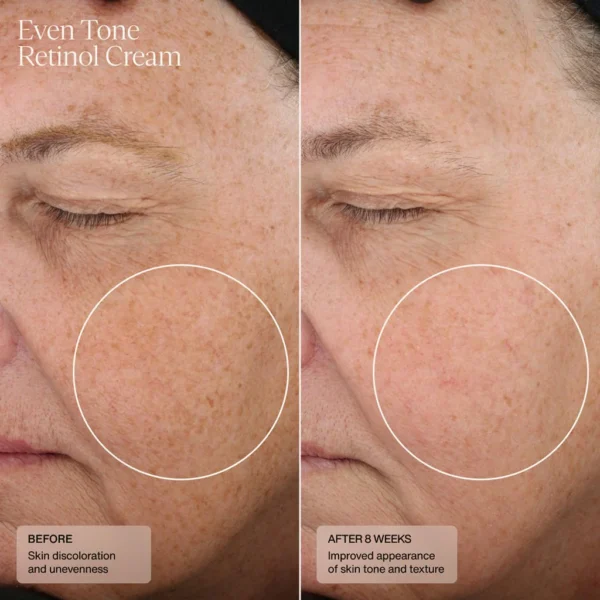 senté even tone retinol cream